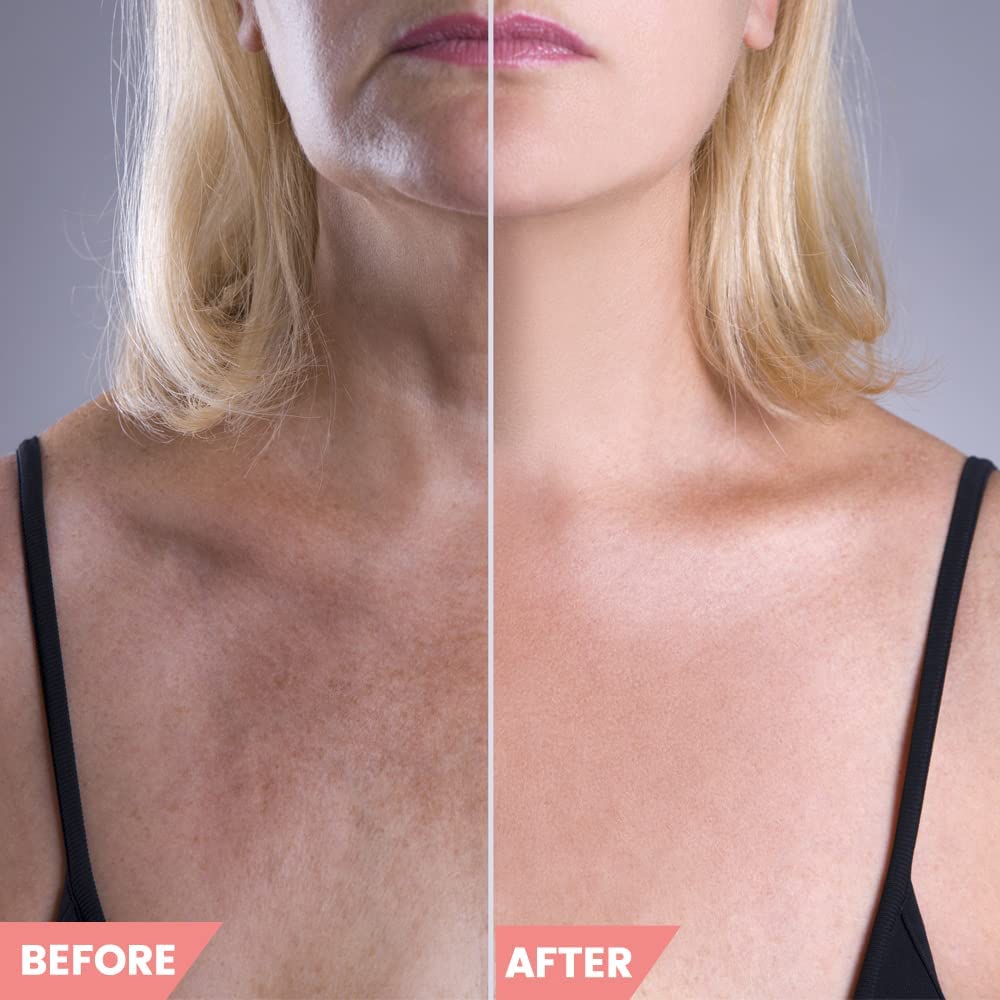 Chest Wrinkle Pads – Decollete Anti Wrinkle Chest Neck Pads - Set of 2 Silicone Chest Pad and 1 Anti Wrinkle Neck Pad